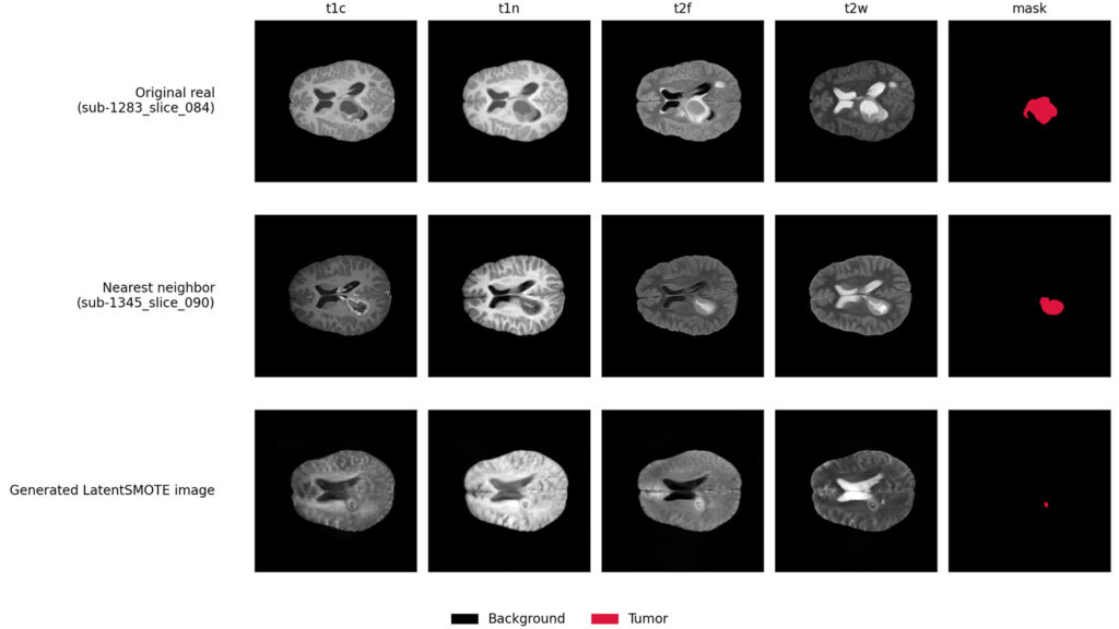 Image showing authentic cancer MR scans and AI-generated images